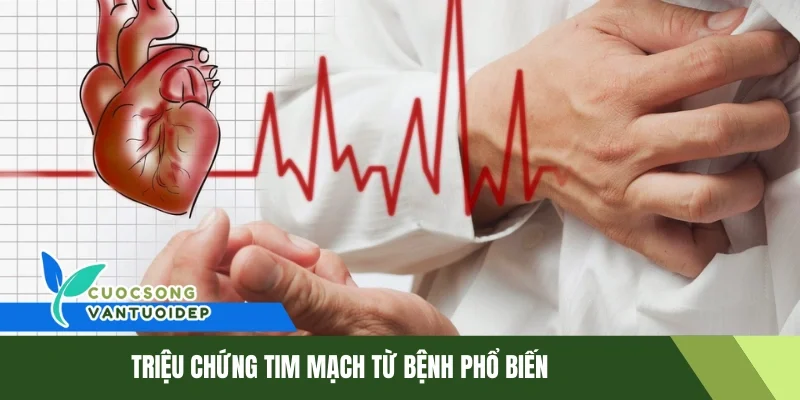 Nhận Biết Sớm Triệu Chứng Tim Mạch Bảo Vệ Sức Khỏe 1 Triệu chứng tim mạch từ bệnh phổ biến