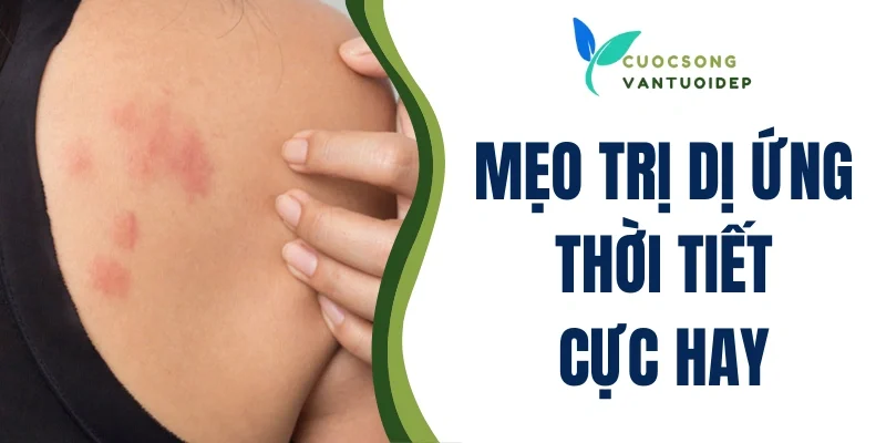 Mẹo trị dị ứng thời tiết